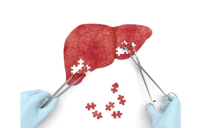 liver transplant guidelines