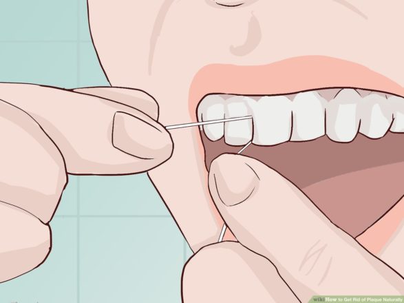 Get Rid of Teeth Tartar